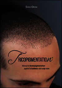 9788899460020 - Tricopigmentation. The manual of dermopigmentation applied to baldness and scalp scars